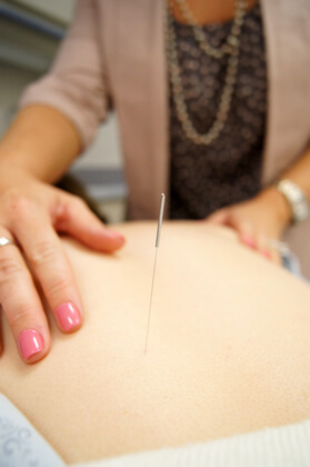 Unger Acupuncture